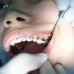 Dental Financing Options