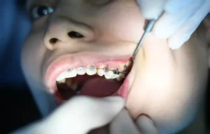 Dental Financing Options