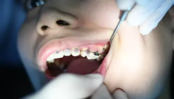 Dental Financing Options