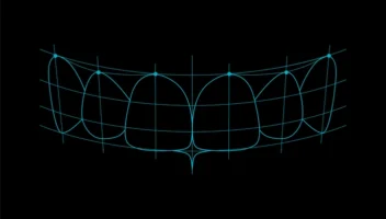 Digital Smile Design