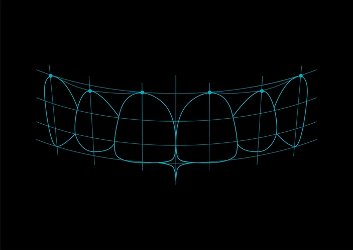 Digital Smile Design