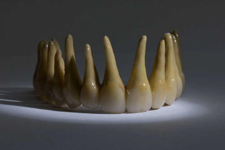 Abnormalities of Tooth Form