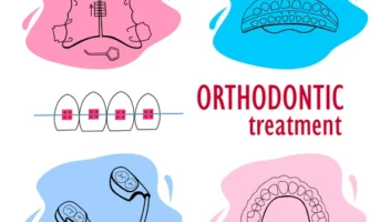 Index of Orthodontic Treatment Need (IOTN)