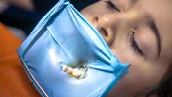 Restoration of Carious Primary Teeth