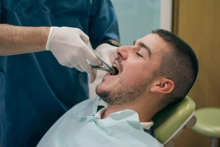 Dental Extraction