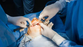 Principles of Surgery of the Mouth