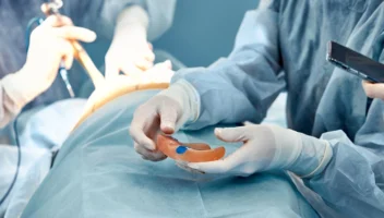 Minor pre-prosthetic surgery