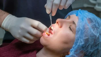 Oral surgery hard tissue lesions