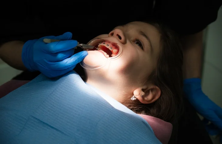 Orthodontic surgical procedures