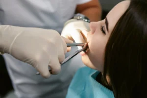 Removal of Unerupted Teeth