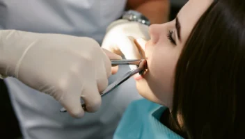 Removal of Unerupted Teeth