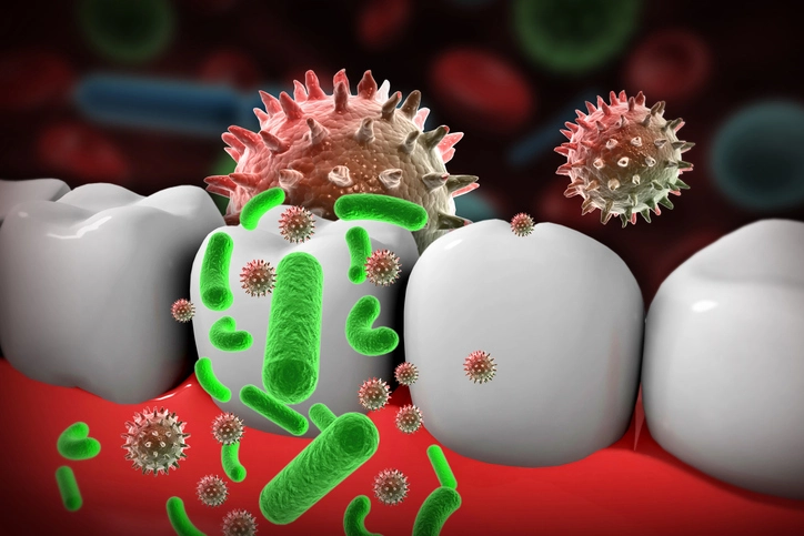 Viral Infections of the Mouth