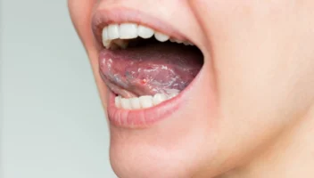 Abnormalities of the Lips and Tongue