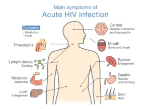 HIV and AIDS