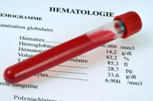 Haematological Disease