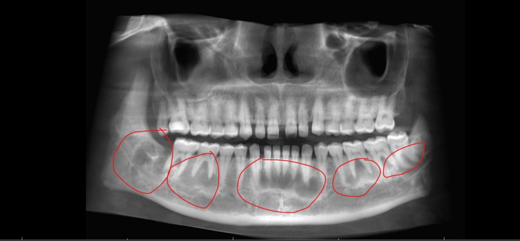 Details Image